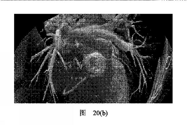 2020506452-ＨＭＤＳに基づく医学画像形成装置 図000025