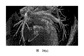 2020506452-ＨＭＤＳに基づく医学画像形成装置 図000026