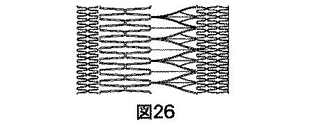 2018530386-植え込み可能弁及び方法 図000028