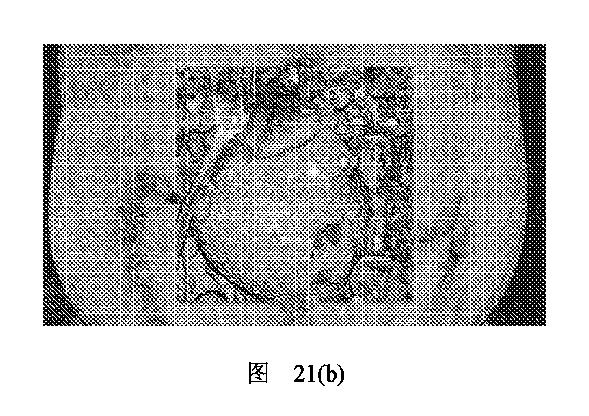 2020506452-ＨＭＤＳに基づく医学画像形成装置 図000028