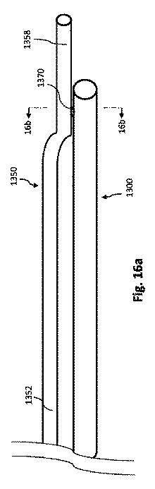 2017521177-複数の平坦部分を持つコアワイヤを有する血管内デバイス、システム及び方法 図000029