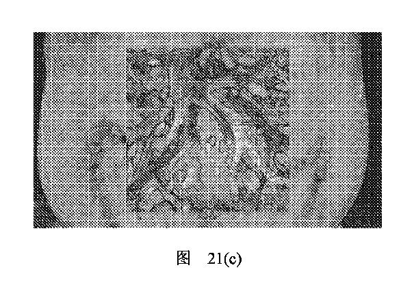 2020506452-ＨＭＤＳに基づく医学画像形成装置 図000029