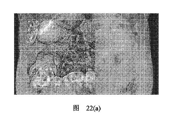 2020506452-ＨＭＤＳに基づく医学画像形成装置 図000030