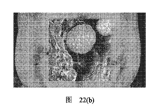 2020506452-ＨＭＤＳに基づく医学画像形成装置 図000031