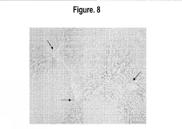 2015502753-鉄関連障害を診断および治療するための組成物および方法 図000032