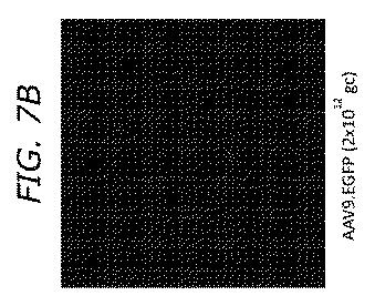 2019505588-ダノン病およびオートファジーの他の障害の治療のための方法 図000032