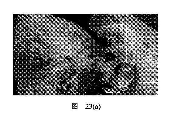 2020506452-ＨＭＤＳに基づく医学画像形成装置 図000032