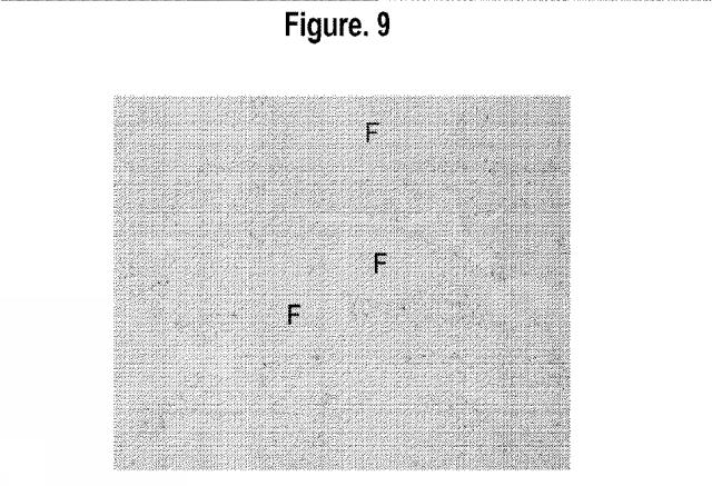 2015502753-鉄関連障害を診断および治療するための組成物および方法 図000033
