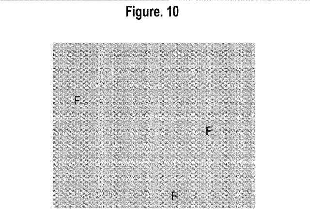 2015502753-鉄関連障害を診断および治療するための組成物および方法 図000034