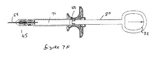 2016537108-安全注射器を用いた薬品送達のためのシステムおよび方法 図000034