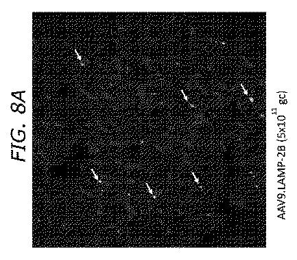 2019505588-ダノン病およびオートファジーの他の障害の治療のための方法 図000034