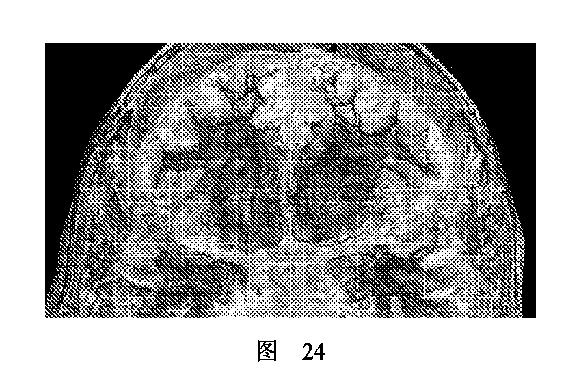 2020506452-ＨＭＤＳに基づく医学画像形成装置 図000034