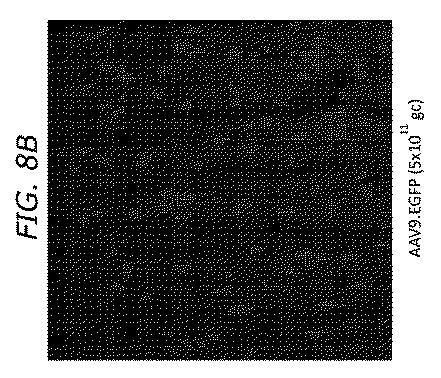 2019505588-ダノン病およびオートファジーの他の障害の治療のための方法 図000035