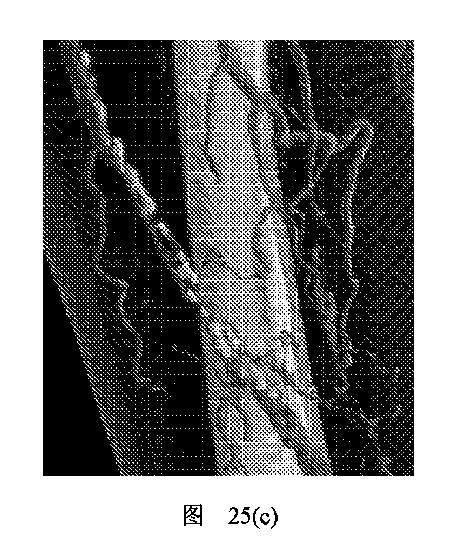 2020506452-ＨＭＤＳに基づく医学画像形成装置 図000037