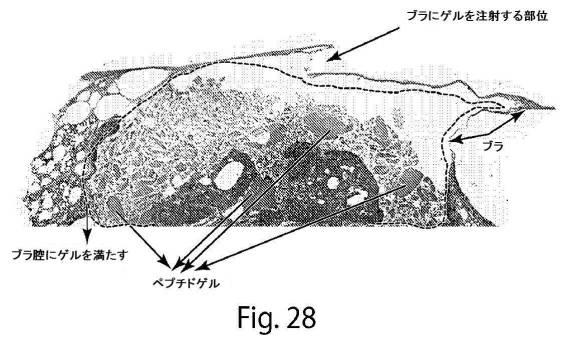 2017513928-肺大気胞を治療するための自発組織化ペプチド 図000038