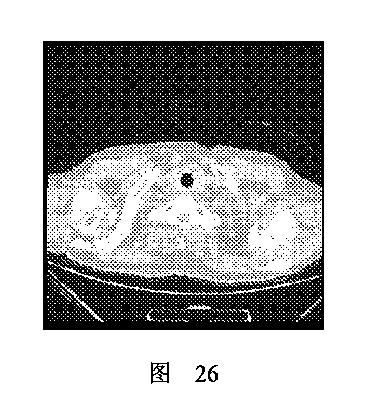 2020506452-ＨＭＤＳに基づく医学画像形成装置 図000038