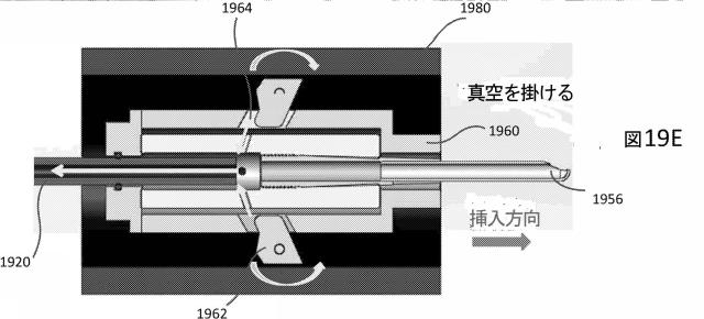 2015500690-組織切除のための挿入可能な内視鏡器具 図000039