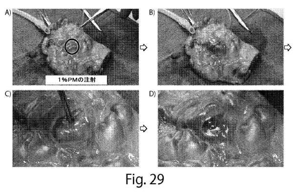 2017513928-肺大気胞を治療するための自発組織化ペプチド 図000039
