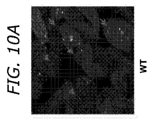 2019505588-ダノン病およびオートファジーの他の障害の治療のための方法 図000039