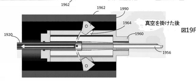 2015500690-組織切除のための挿入可能な内視鏡器具 図000040