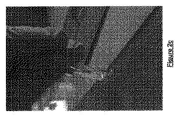 2018516648-止血装置 図000040