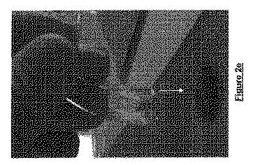 2018516648-止血装置 図000042