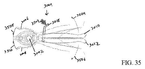 2020534100-患者装着型の外科用リトラクタ 図000043