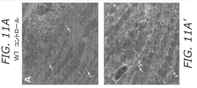 2019505588-ダノン病およびオートファジーの他の障害の治療のための方法 図000044