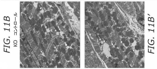 2019505588-ダノン病およびオートファジーの他の障害の治療のための方法 図000045