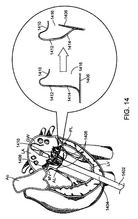 2015506768-人工弁を組織に係合させるための方法および装置 図000046
