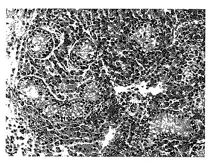 2017521079-生殖系列細胞を切除するＮＡＮＯＳノックアウト 図000050