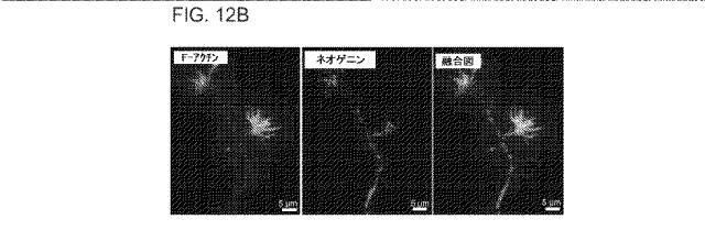 2019517480-脊髄損傷及び疼痛を処置するための抗ＲＧＭａ（Ｒｅｐｕｌｓｉｖｅ  Ｇｕｉｄａｎｃｅ  Ｍｏｌｅｃｕｌｅ  Ａ）アンタゴニスト抗体 図000059