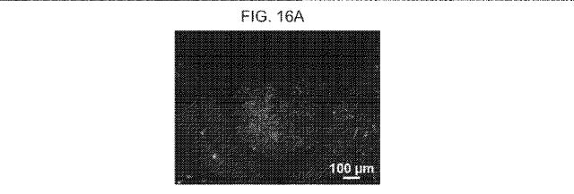 2019517480-脊髄損傷及び疼痛を処置するための抗ＲＧＭａ（Ｒｅｐｕｌｓｉｖｅ  Ｇｕｉｄａｎｃｅ  Ｍｏｌｅｃｕｌｅ  Ａ）アンタゴニスト抗体 図000066