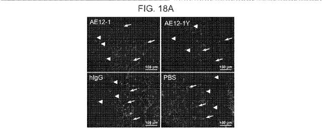 2019517480-脊髄損傷及び疼痛を処置するための抗ＲＧＭａ（Ｒｅｐｕｌｓｉｖｅ  Ｇｕｉｄａｎｃｅ  Ｍｏｌｅｃｕｌｅ  Ａ）アンタゴニスト抗体 図000070