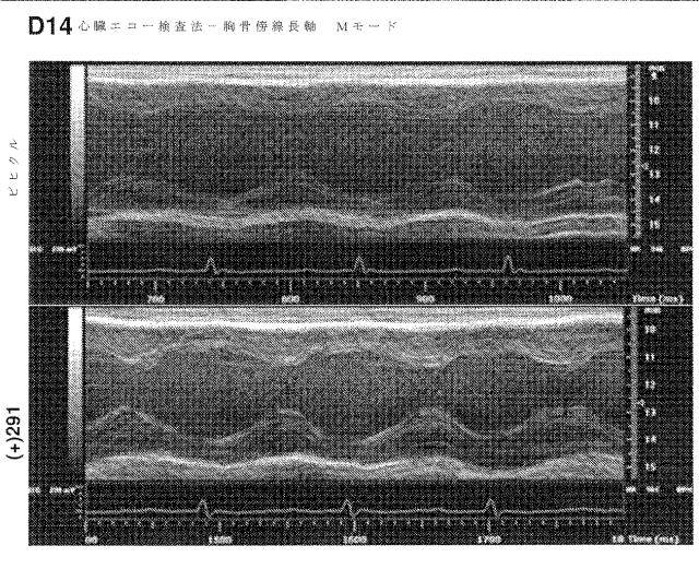 2020516617-冠状動脈障害を治療するための短鎖型デヒドロゲナーゼ活性の阻害剤 図000091