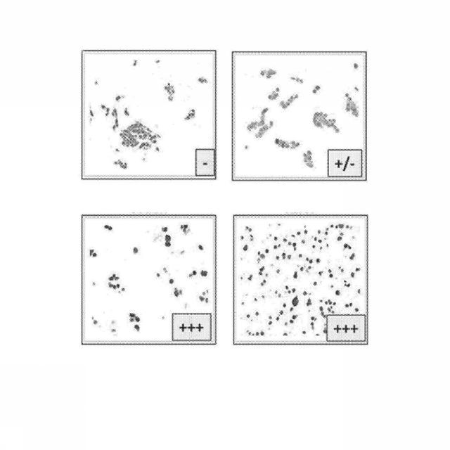 2021500335-グルタミナーゼ阻害薬療法 図000091