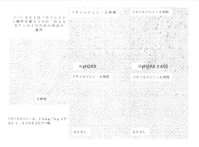 2020516617-冠状動脈障害を治療するための短鎖型デヒドロゲナーゼ活性の阻害剤 図000092