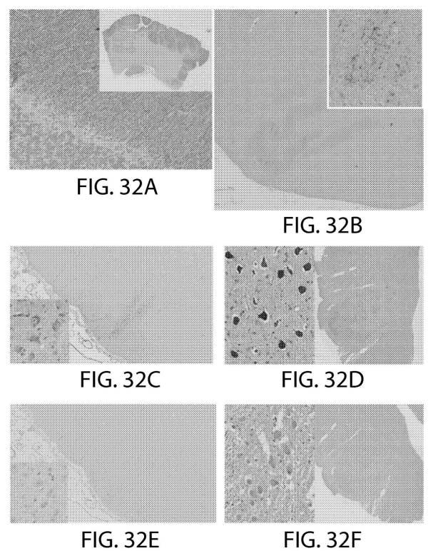 2017527271-ヒト化抗ＢＣＭＡキメラ抗原受容体を使用した癌の処置 図000129